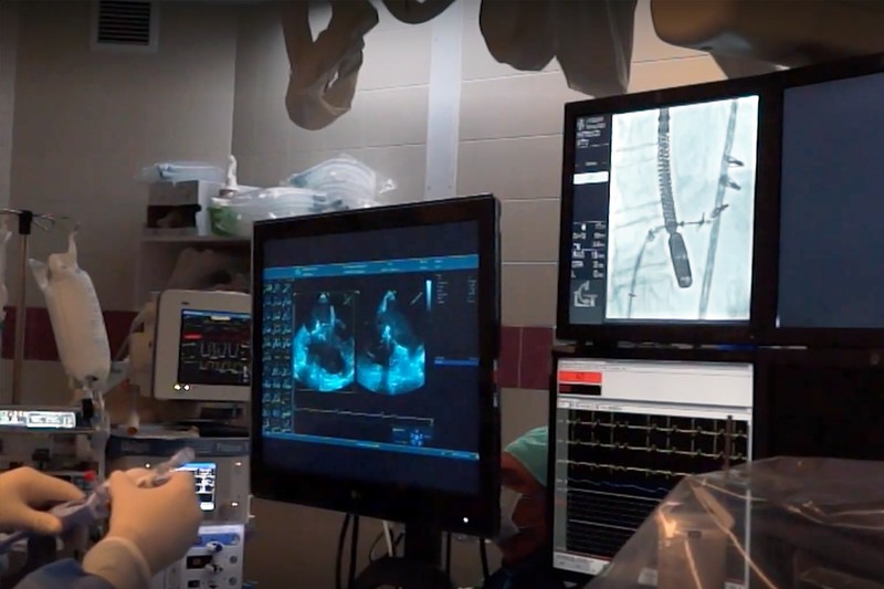 Đại học Debrecen dùng thủ thuật phẫu thuật van tin mới