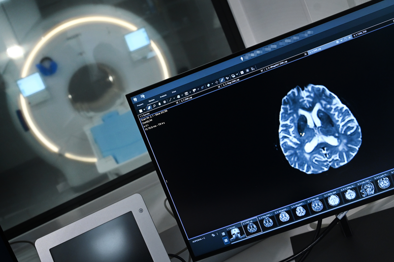 Thiết Bị Chụp Cộng Hưởng Từ (MR) Hiện Đại Được Đưa Vào Sử Dụng Tại Đại Học Debrecen